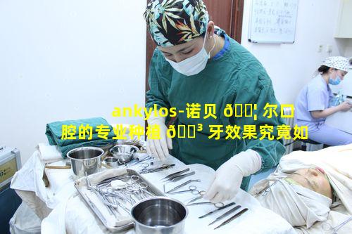 ankylos-诺贝 🐦 尔口腔的专业种植 🌳 牙效果究竟如何